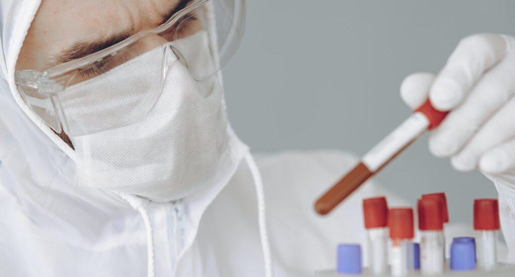 Bloody Depression! A blood test for depression??