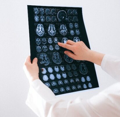 Brain inflammation and depression