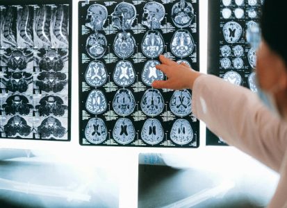 How does ketamine work in the brain? What to know.